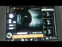 Risoluzione assiale eccellente ultrasonica della macchina 10MHz dell'analizzatore di funzione di calcolo di IOL alta