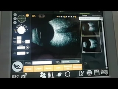 Macchina 10MHz di ricerca di ricerca B del fan osservando distacco della retina