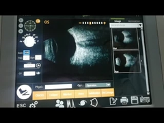 Esame elettromagnetico di malattia del corpo vitreo della macchina ultrasonica dell'analizzatore di B