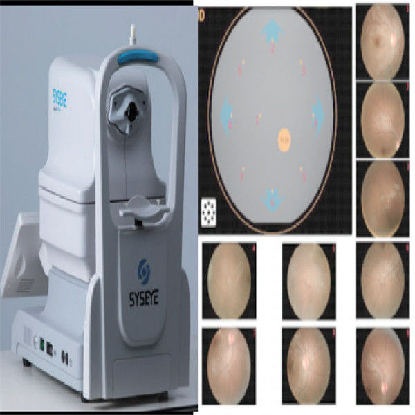 Non Mydriatic Fundus Camera with 13mm Working Distance ±25D Diopter Compensation and 9-position Mosaic for Retinal Imaging
