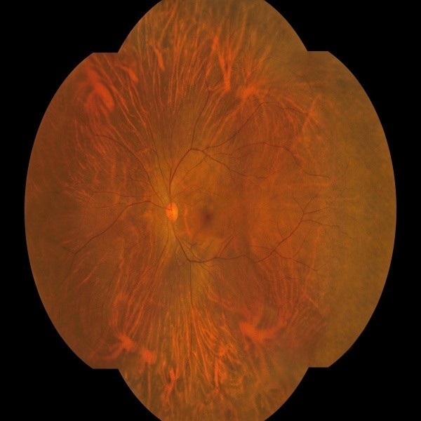 Telecamera del fondo a campo ampio di cattura binoculare automatica con un'operazione a chiave per dispositivi medici oftalmici
