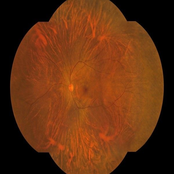 Fotocamera True Color Wide Field Fundus con risoluzione ottica di 8μm e monitor a colori HD da 27 pollici per l'imaging della retina