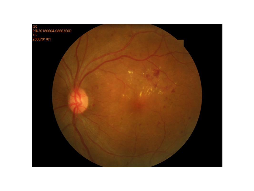 Piccola alta risoluzione di modo dell'allievo di rappresentazione di Digital della macchina fotografica retinica del fondo